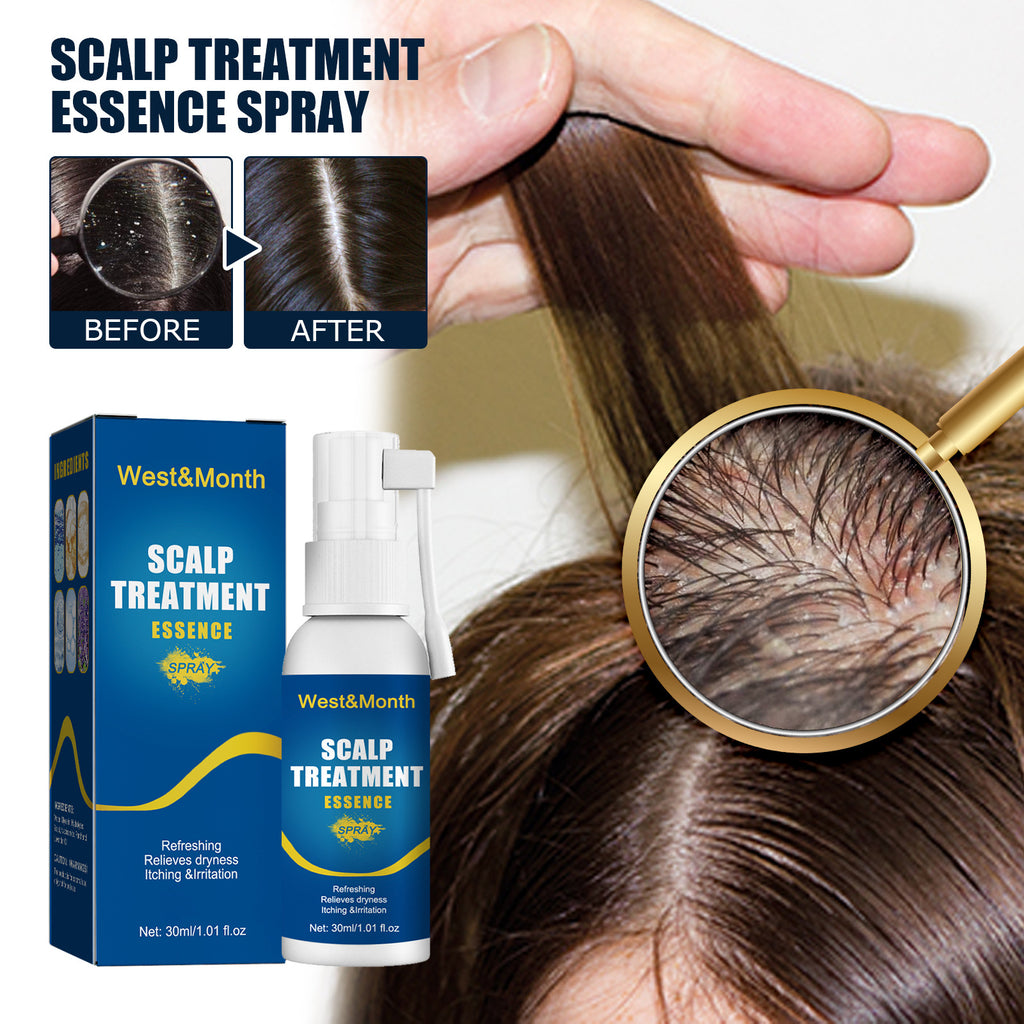 Scalp itch relief hair root care spray